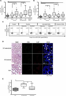 CD3+CD4+LAP+Foxp3-Regulatory Cells of the Colonic Lamina Propria Limit Disease Extension in Ulcerative Colitis